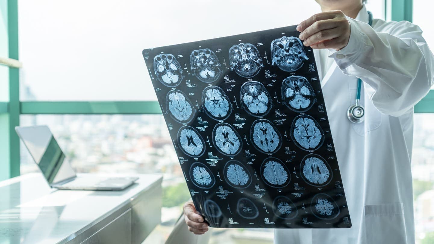 Brain Injury & Head Injury