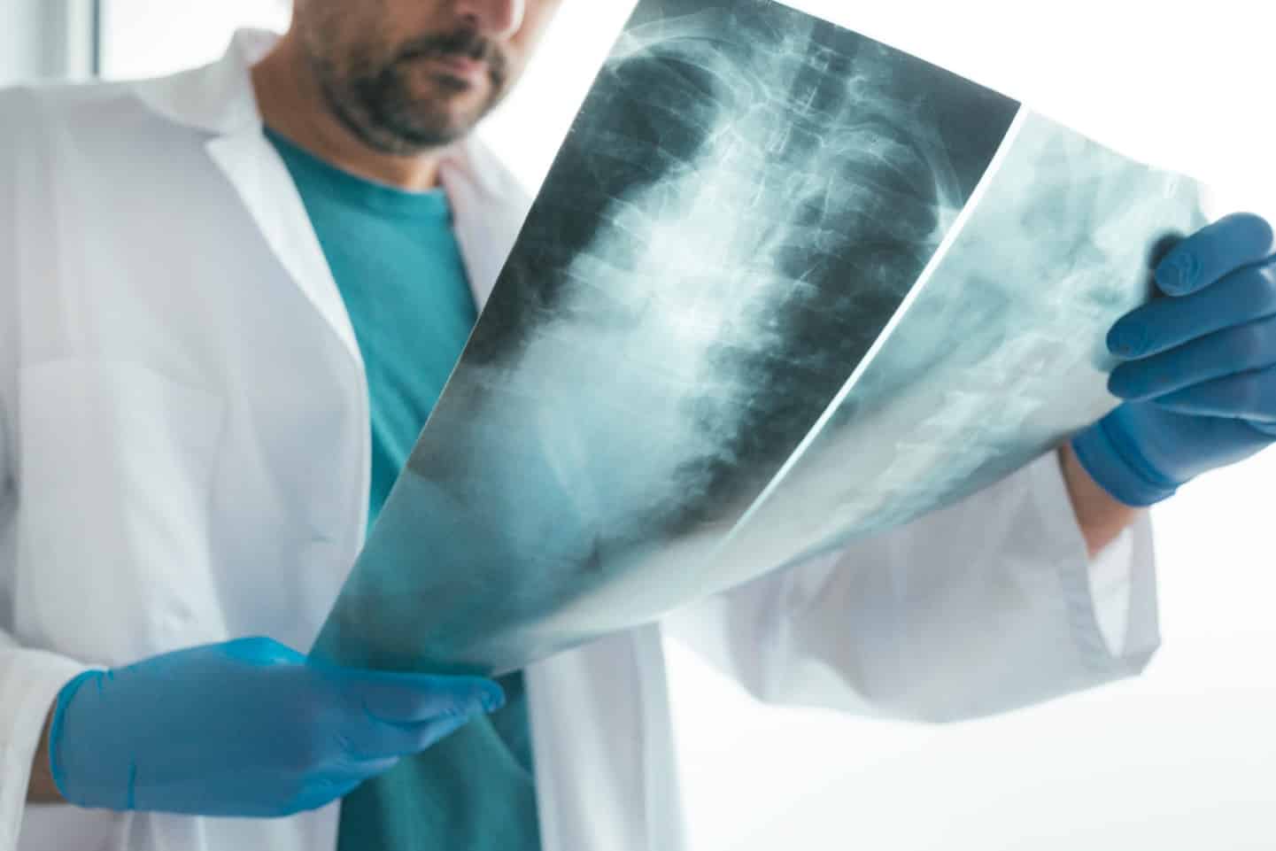Spinal Cord Injury & Paralysis